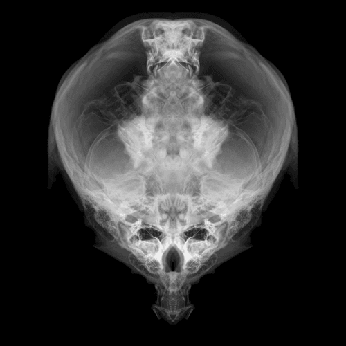 Alien Embryo - 357 of 2000