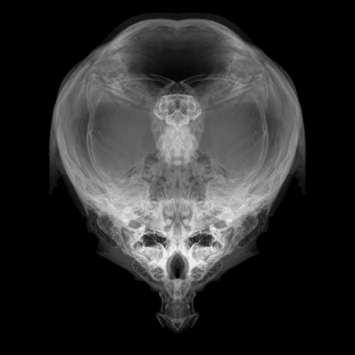 Alien Embryo - 402 of 2000