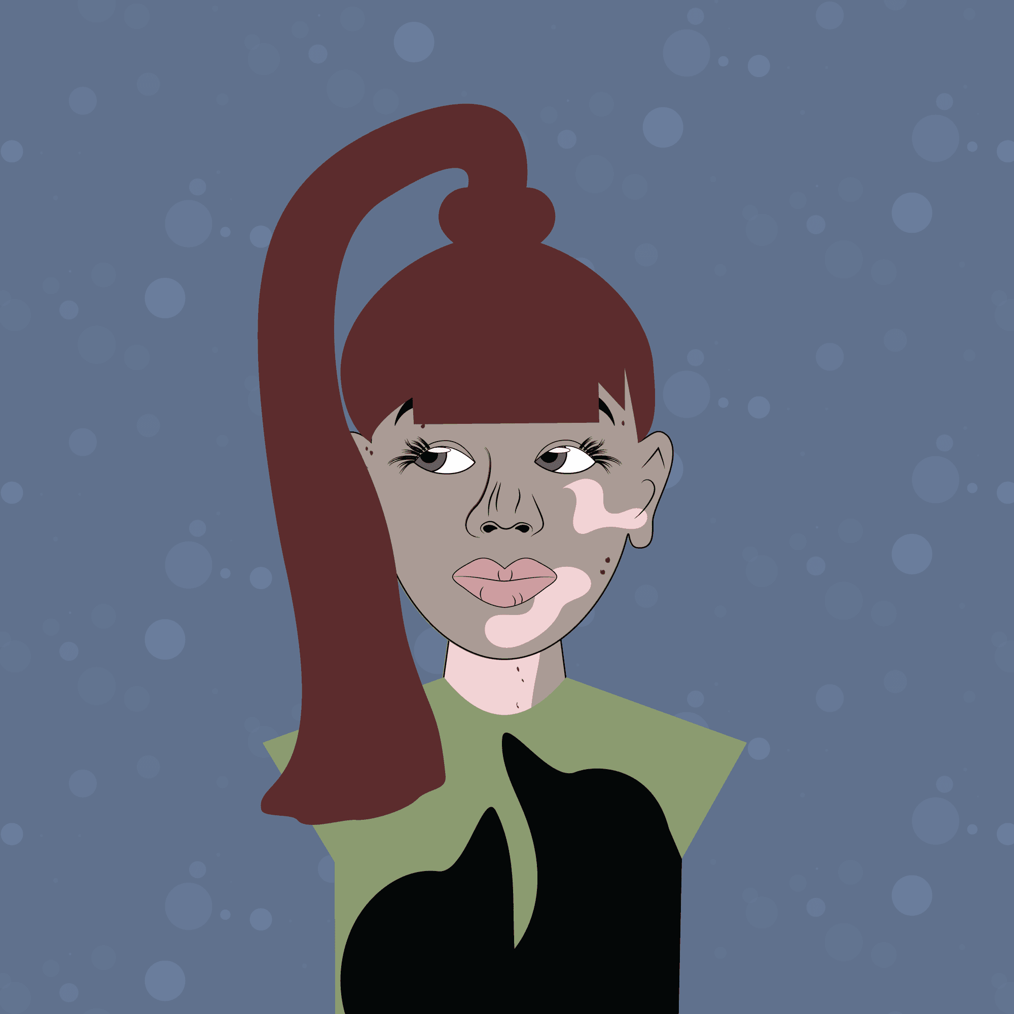 Pretty Vitiligo #887