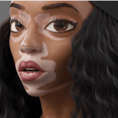 Winnie Harlow