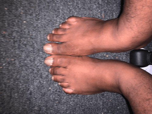 dreesus feet pics