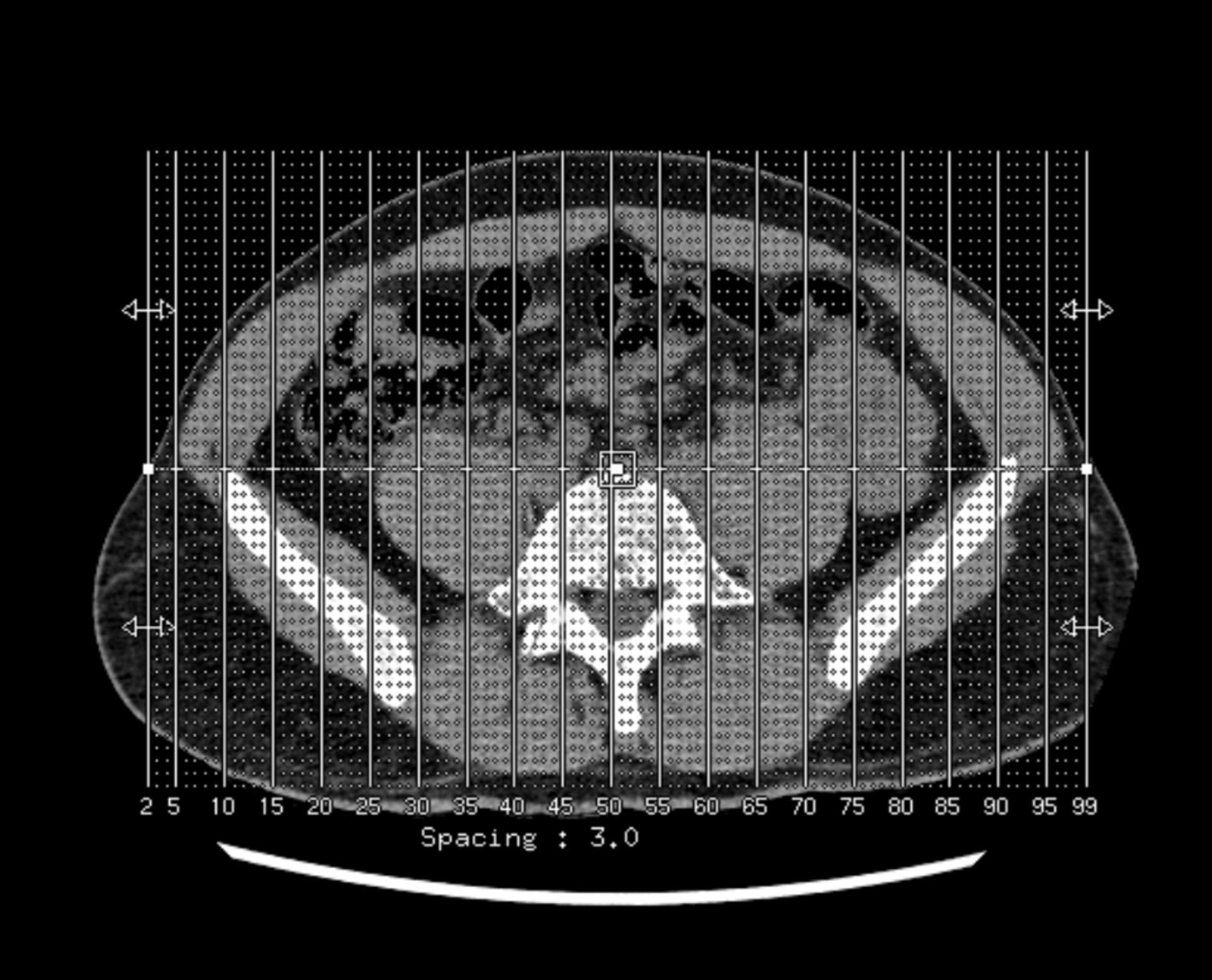 malfunction body Collection OpenSea