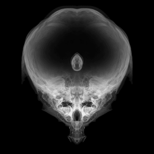 Alien Embryo - 394 of 2000