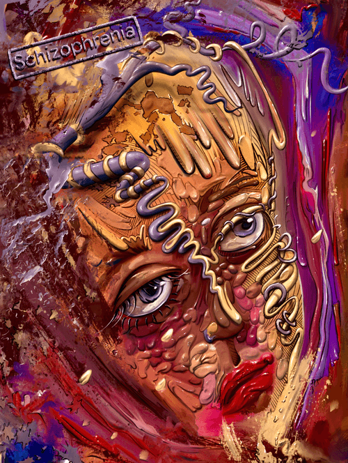 Schizophrenia. #1