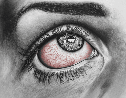 INSOMNIA