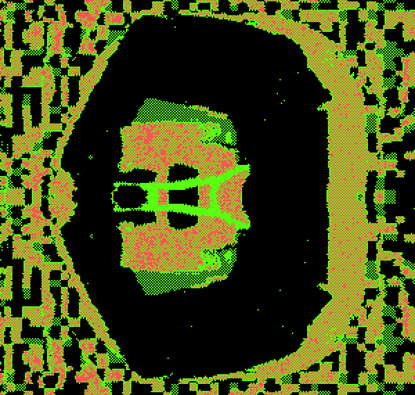 19