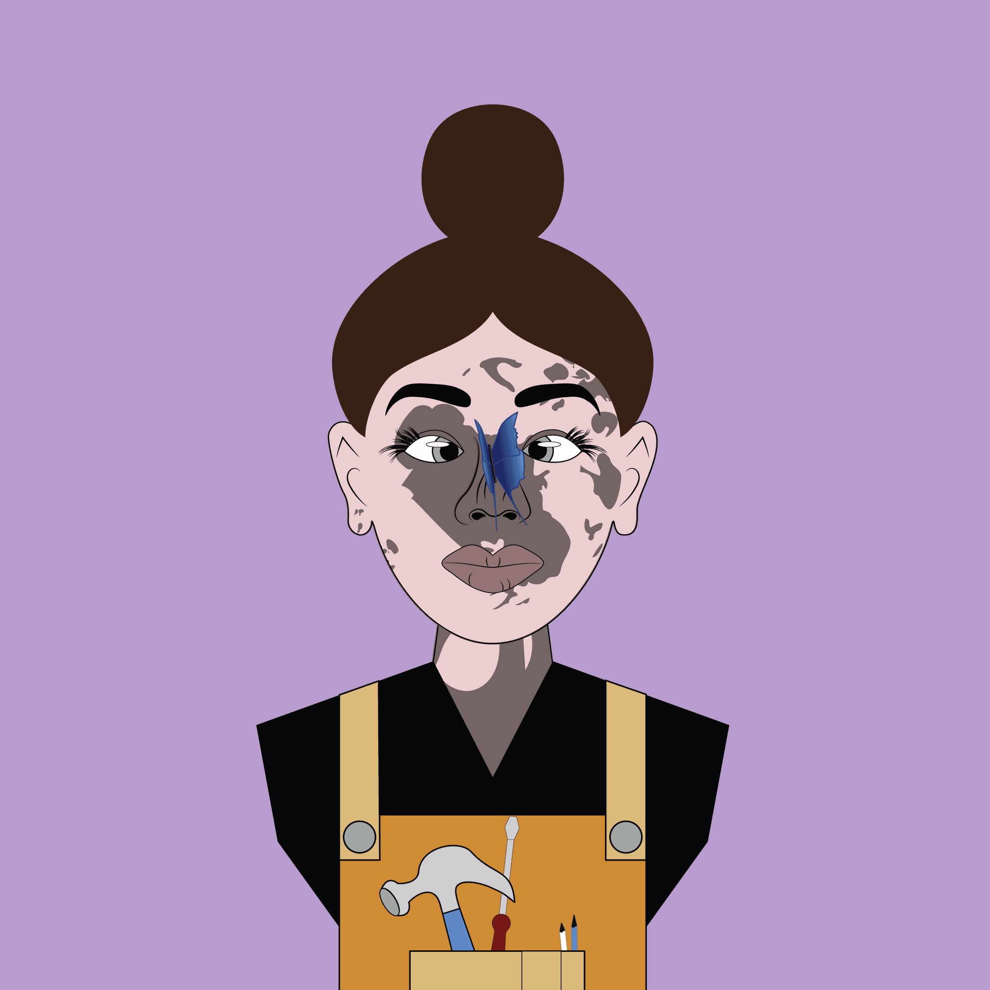 Pretty Vitiligo #778