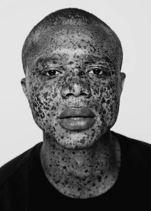 Freckles Portrait