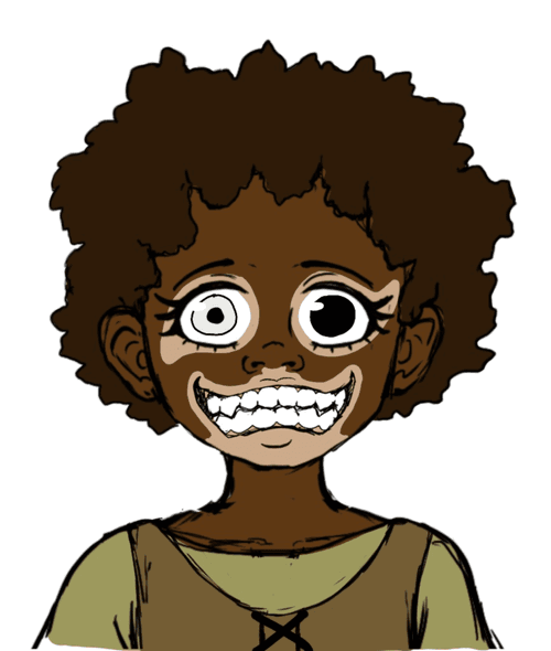 Vitiligo Roma (Crazy 1)
