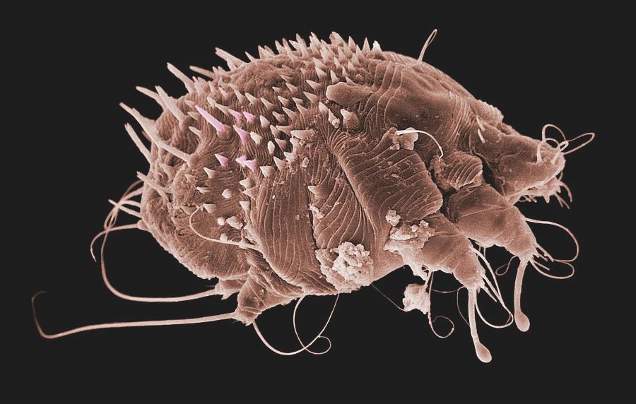 Scabies nymph 🪲 - Pathology art | OpenSea