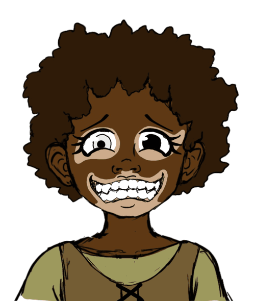 Vitiligo Roma (Crazy 2)