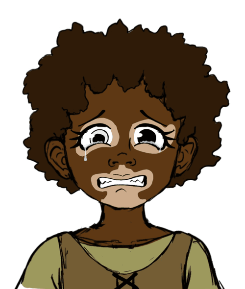 Vitiligo Roma (Scared)