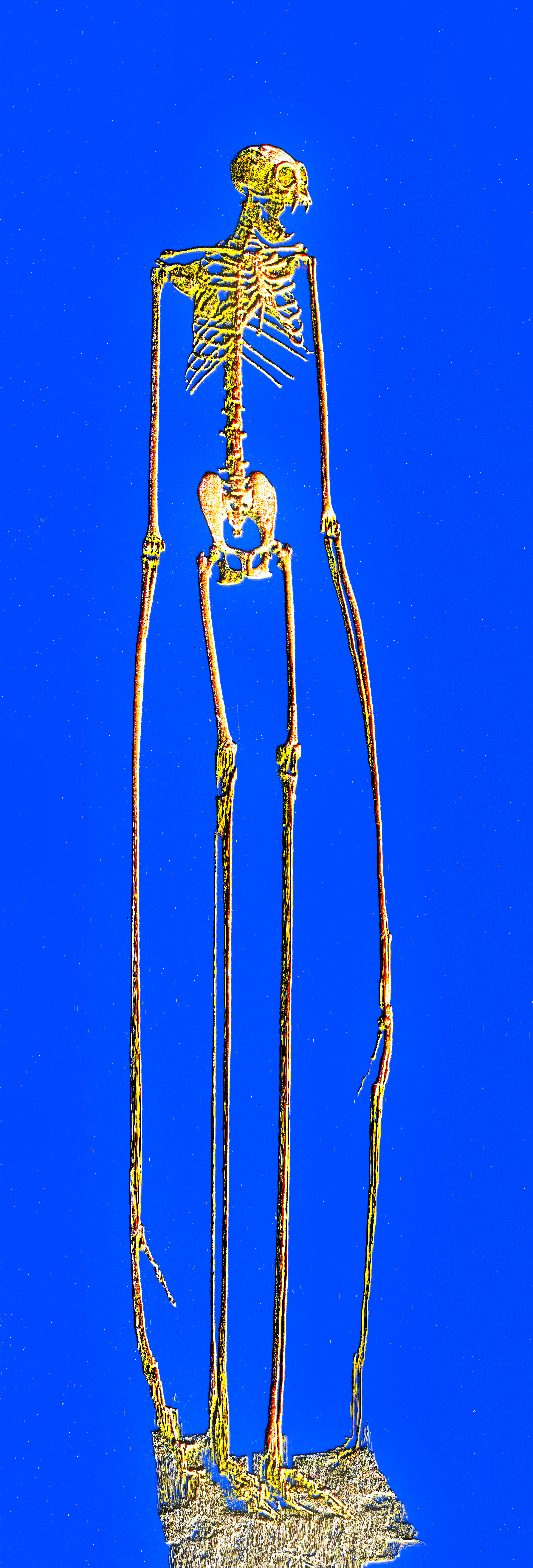 gibbon's skeleton