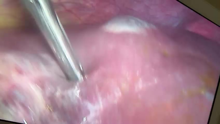 Surgery videos