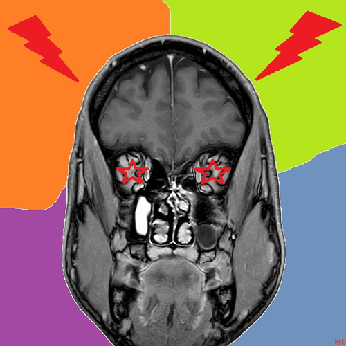 The Best Brain